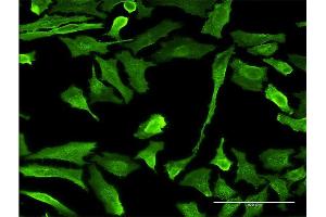 Immunofluorescence of monoclonal antibody to EMR4P on HeLa cell. (EMR4P anticorps  (AA 21-93))