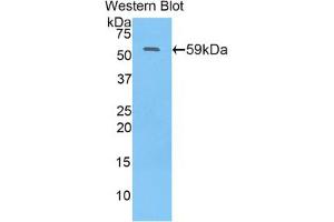 Western blot analysis of the recombinant protein. (N-Acetyl alpha-D-Glucosaminidase (AA 429-710) anticorps)