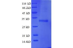 SDS-PAGE (SDS) image for Ubiquitin-Conjugating Enzyme E2W (UBE2W) (AA 1-151), (full length) protein (His-SUMO Tag) (ABIN5711601)