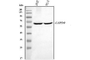 Western blot analysis of CARD9 using anti-CARD9 antibody (ABIN7599386). (CARD9 anticorps  (AA 1-429))