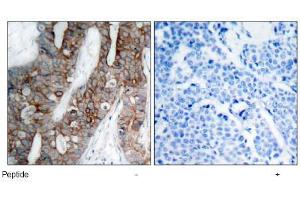 Image no. 1 for anti-Integrin beta 3 (ITGB3) (AA 771-775) antibody (ABIN197246) (Integrin beta 3 anticorps  (AA 771-775))