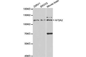 Western blot analysis of extracts of various cell lines, using AP2A2 antibody.
