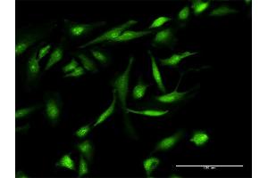 Immunofluorescence of purified MaxPab antibody to GEMIN7 on HeLa cell. (GEMIN7 anticorps  (AA 1-131))