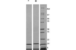 SDS-PAGE of Human Interleukin-3 Recombinant Protein (Animal Free) SDS-PAGE of Human Interleukin-3 Animal Free Recombinant Protein. (IL-3 Protéine)