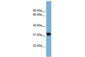 WB Suggested Anti-CBR1 Antibody Titration:  0. (CBR1 anticorps  (Middle Region))