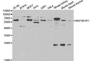 Western blot analysis of extracts of various cells, using TAB1 antibody. (TAB1 anticorps)