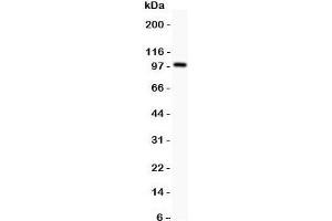 Western blot testing of Prothrombin antbody and rat testis;  Predicted size: 70KD;  Observed size: 100KD