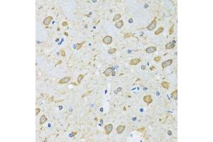 Immunohistochemistry of paraffin-embedded mouse brain using ATG7 antibody.