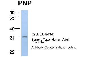 Host:  Rabbit  Target Name:  PNP  Sample Type:  Human Adult Placenta  Antibody Dilution:  1. (NP (Middle Region) anticorps)
