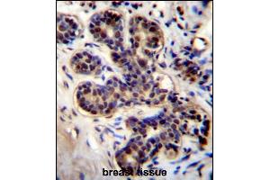 PROX2 Antibody (C-term) (ABIN656460 and ABIN2845744) immunohistochemistry analysis in formalin fixed and paraffin embedded human breast tissue followed by peroxidase conjugation of the secondary antibody and DAB staining. (PROX2 anticorps  (C-Term))