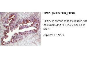 Image no. 1 for anti-Metalloproteinase Inhibitor 2 (TIMP2) (N-Term) antibody (ABIN2787967) (TIMP2 anticorps  (N-Term))