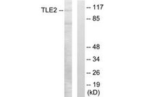 Western Blotting (WB) image for anti-Transducin-Like Enhancer Protein 2 (TLE2) (AA 211-260) antibody (ABIN2889550) (TLE2 anticorps  (AA 211-260))