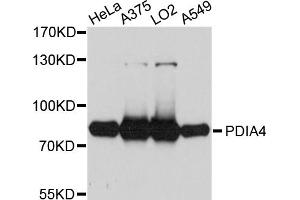 Western blot analysis of extracts of various cell lines, using PDIA4 antibody (ABIN5972424) at 1/1000 dilution. (PDIA4 anticorps)