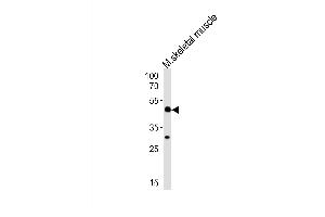 Western blot analysis of lysate from mouse skeletal muscle tissue lysate, using Mouse Hoxc10 Antibody at 1:1000 at each lane.