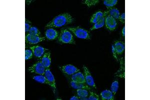 Immunofluorescence Analysis of HeLa cells labeling IGF-1 with IGF-1 Mouse Monoclonal Antibody (CTC05) labeled with CF647R (Green). (IGF1 anticorps)