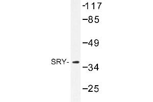 Image no. 1 for anti-Sex Determining Region Y (SRY) antibody (ABIN272215) (SRY anticorps)