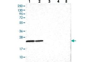Western blot analysis of Lane 1: RT-4, Lane 2: U-251 MG, Lane 3: Human Plasma, Lane 4: Liver, Lane 5: Tonsil with SOX7 polyclonal antibody  at 1:100-1:250 dilution. (PINX1 anticorps)