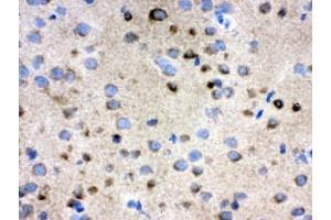 IHC testing of frozen rat brain tissue with TCP1 antibody. (CCT4 anticorps)