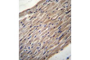 PLOD1 Antibody (N-term) (ABIN656585 and ABIN2845847) immunohistochemistry analysis in formalin fixed and paraffin embedded human heart tissue followed by peroxidase conjugation of the secondary antibody and DAB staining. (PLOD1 anticorps  (N-Term))