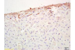 Formalin-fixed and paraffin embedded mouse liver labeled with Rabbit Anti FABP3/Cardiac FABP Polyclonal Antibody, Unconjugated (ABIN1387630) at 1:200 followed by conjugation to the secondary antibody and DAB staining (FABP3 anticorps  (AA 8-100))