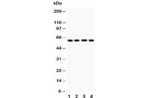 Western blot testing of HEXA antibody and Lane 1:  human placenta (Hexosaminidase A anticorps  (C-Term))