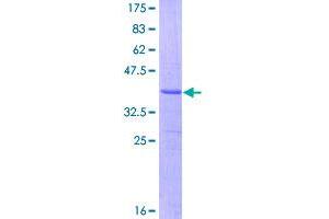 Image no. 1 for N-Acylsphingosine Amidohydrolase (Acid Ceramidase) 1 (ASAH1) (AA 25-124) protein (GST tag) (ABIN1345780)