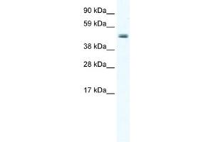 WB Suggested Anti-ELP4 Antibody Titration:  2. (ELP4 anticorps  (Middle Region))