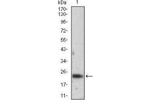 Western blot analysis using FTL mouse mAb against K562 cell lysate. (FTL anticorps  (full length))