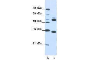 WDR6 antibody used at 0. (WDR6 anticorps  (C-Term))