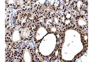 IHC-P Image PAX8 antibody detects PAX8 protein at cytosol and nucleus on rat thyroid gland by immunohistochemical analysis.