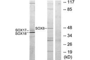 Western blot analysis of extracts from COS7 cells, treated with serum 10% 30', using SOX8/9/17/18 Antibody.
