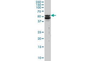 VIM monoclonal antibody (M01), clone 3E9 Western Blot analysis of VIM expression in HeLa .