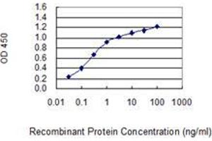 Detection limit for recombinant GST tagged SAGE1 is 0. (SAGE1 anticorps  (AA 357-455))