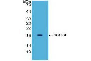 Western blot analysis of recombinant Human HMGA1. (HMGA1 anticorps  (AA 3-107))