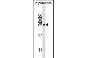 CRYBA1 Antibody (Center) (ABIN656311 and ABIN2845613) western blot analysis in human placenta tissue lysates (35 μg/lane). (CRYBA1 anticorps  (AA 104-133))