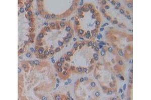 Used in DAB staining on fromalin fixed paraffin- embedded Kidney tissue (HPS4 anticorps  (AA 6-192))