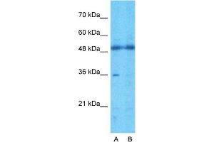 Host:  Rabbit  Target Name:  TMEM30A  Sample Type:  721_B  Lane A:  Primary Antibody  Lane B:  Primary Antibody + Blocking Peptide  Primary Antibody Concentration:  1ug/ml  Peptide Concentration:  5ug/ml  Lysate Quantity:  25ug/lane/lane  Gel Concentration:  0. (TMEM30A anticorps  (Middle Region))