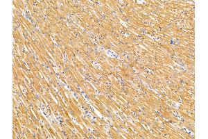 ABIN7094667 and ABIN7098718 at 1/100 staining Rat heart tissue by IHC-P. (Chromosome 6 Open Reading Frame 134 (C6orf134) (Internal Region) anticorps)