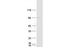 Validation with Western Blot