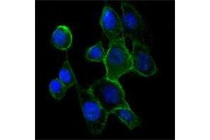 Immunofluorescence analysis of A431 cells using CDH2 antibody (green). (N-Cadherin anticorps)