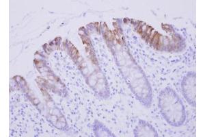 IHC-P Image Biglycan antibody detects BGN protein at cytosol on human Colon Epithelium by immunohistochemical analysis. (Biglycan anticorps)