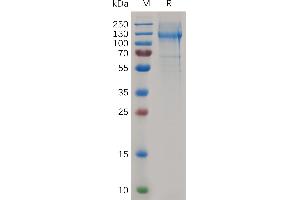 Mouse NCL Protein, His Tag on SDS-PAGE under reducing condition.