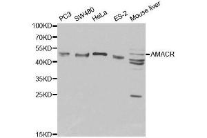 Western blot analysis of extracts of various cell lines, using AMACR antibody. (AMACR anticorps  (AA 1-198))