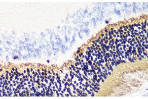 Immunohistochemistry of paraffin-embedded Rat retina using PDC Polyclonal Antibody at dilution of 1:200 (40x lens). (Phosducin anticorps)