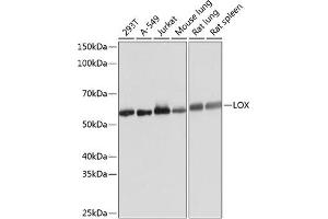 Western blot analysis of extracts of various cell lines, using LOX Rabbit mAb (ABIN7268347) at 1:1000 dilution. (LOX anticorps)