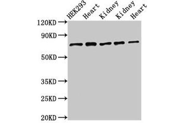 SLC25A12 antibody  (AA 202-317)