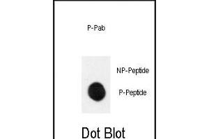 Dot blot analysis of anti-Phospho-MEK1-p Antibody (ABIN389995 and ABIN2839772) on nitrocellulose membrane. (MEK1 anticorps  (pSer222))