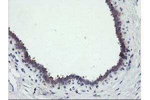 Image no. 5 for anti-Receptor (TNFRSF)-Interacting serine-threonine Kinase 1 (RIPK1) (AA 133-422) antibody (ABIN1490909)