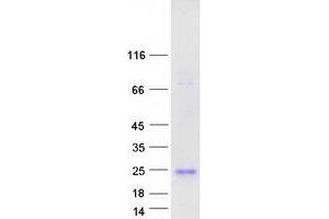 Validation with Western Blot