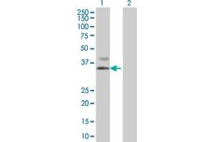 Lane 1: ASGR2 transfected lysate ( 31. (ASGR2 293T Cell Transient Overexpression Lysate(Denatured))